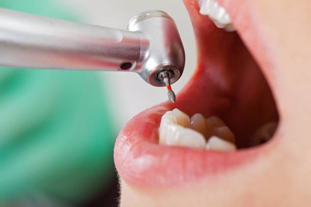 Best Pediatric Emergency Dentist in Cosmopolis, WA